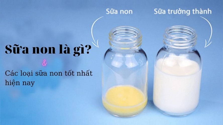 [Chia sẻ] Top các loại sữa non tốt nhất hiện nay được khuyên dùng