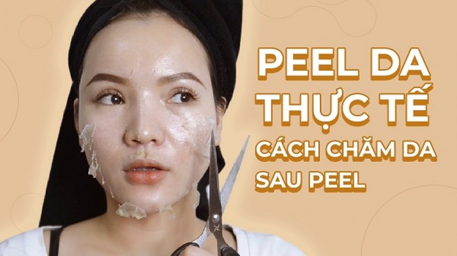 [Giải Đáp] Dùng gì sau khi Peel da The Ordinary?