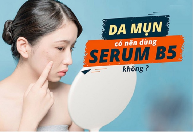 Da mụn rất nên sử dụng serum B5