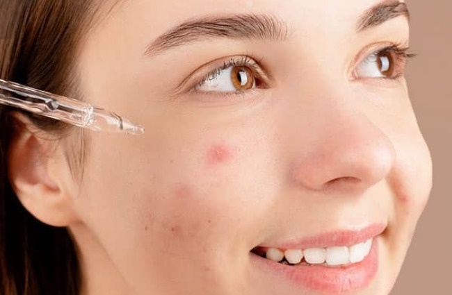 Tiêu chí chọn serum trị mụn hiệu quả